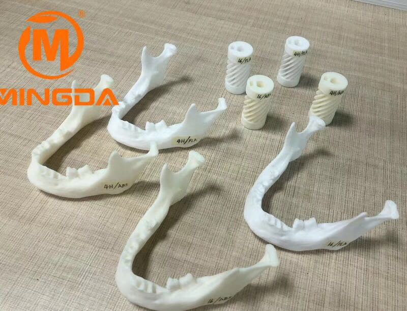 工業(yè)級3D打印機在牙科行業(yè)的應用(圖1)