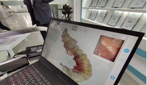 3D打印技術(shù)在牙科義齒領(lǐng)域中牙套制作的應用是怎樣的呢?(圖2) 3D打印技術(shù)在牙科義齒領(lǐng)域中牙套制作的應用是怎樣的呢?(圖2)